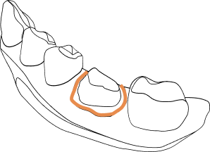 Smart Margin graphic