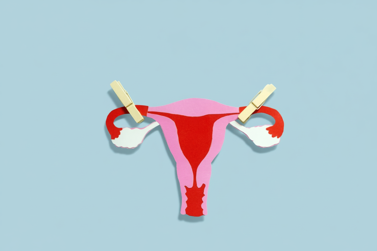 Illustration of a female reproductive system with clothespins clipping the fallopian tubes on each side.