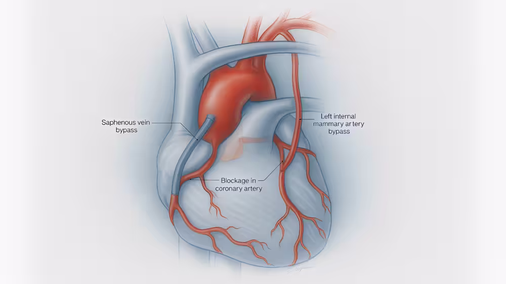 image of a heart