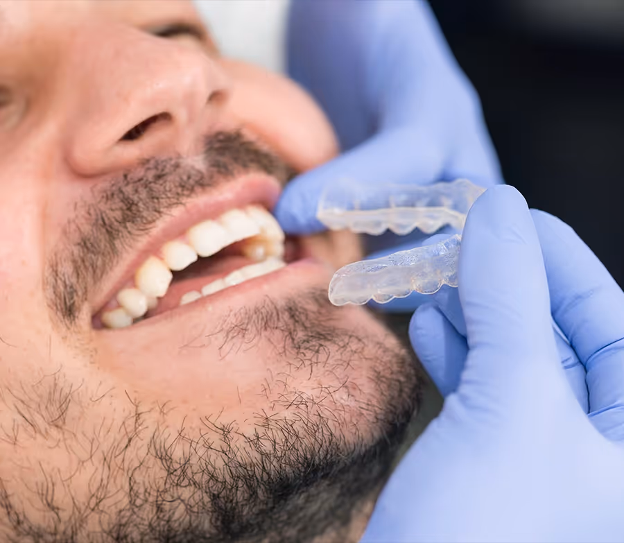 A man getting clear aligners fitted by a dentist.