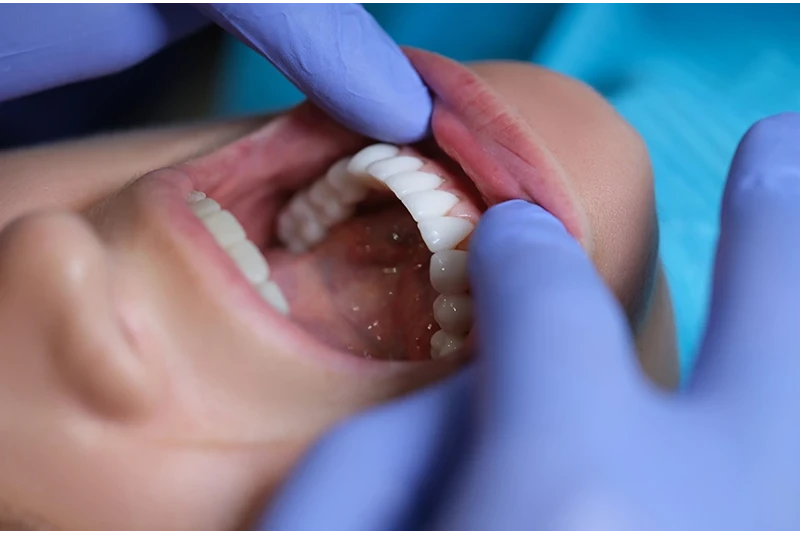 Cosmetic bonding