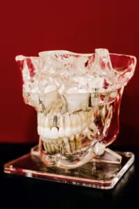 dental implant in a fake transparent plastic skull