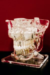 dental implant in a fake transparent plastic skull