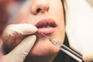 Woman's bottom lip getting filled