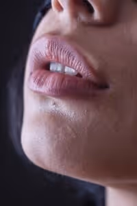 Women's pink lips after lip filler treatment