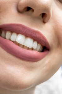 Woman with filled lips, smiling