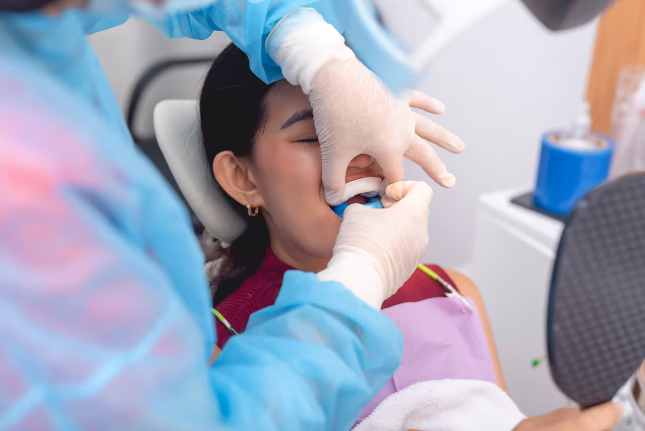 Fluoride Treatment