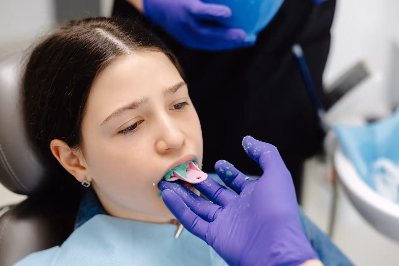 Dental Sealants