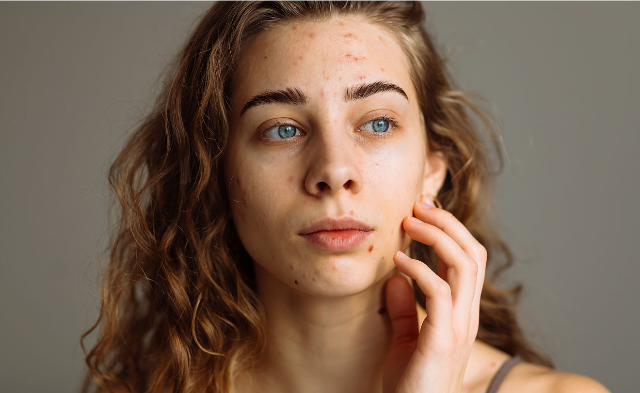 A woman touching her hand to her cheek.