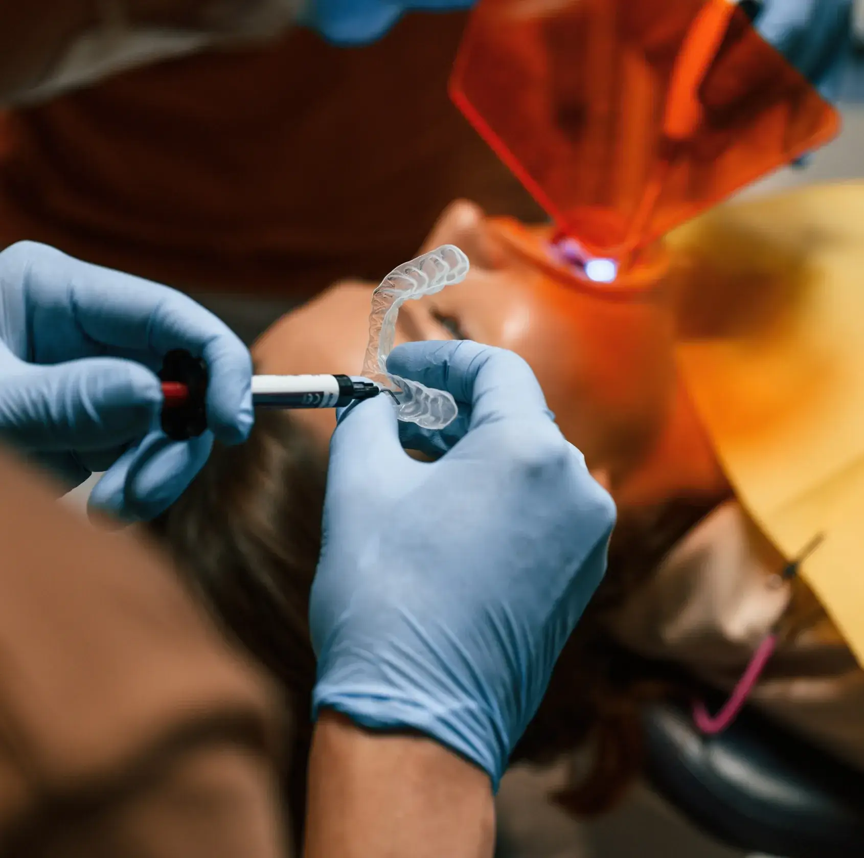 A dentist wearing gloves applies adhesive to a dental mold in a treatment procedure.