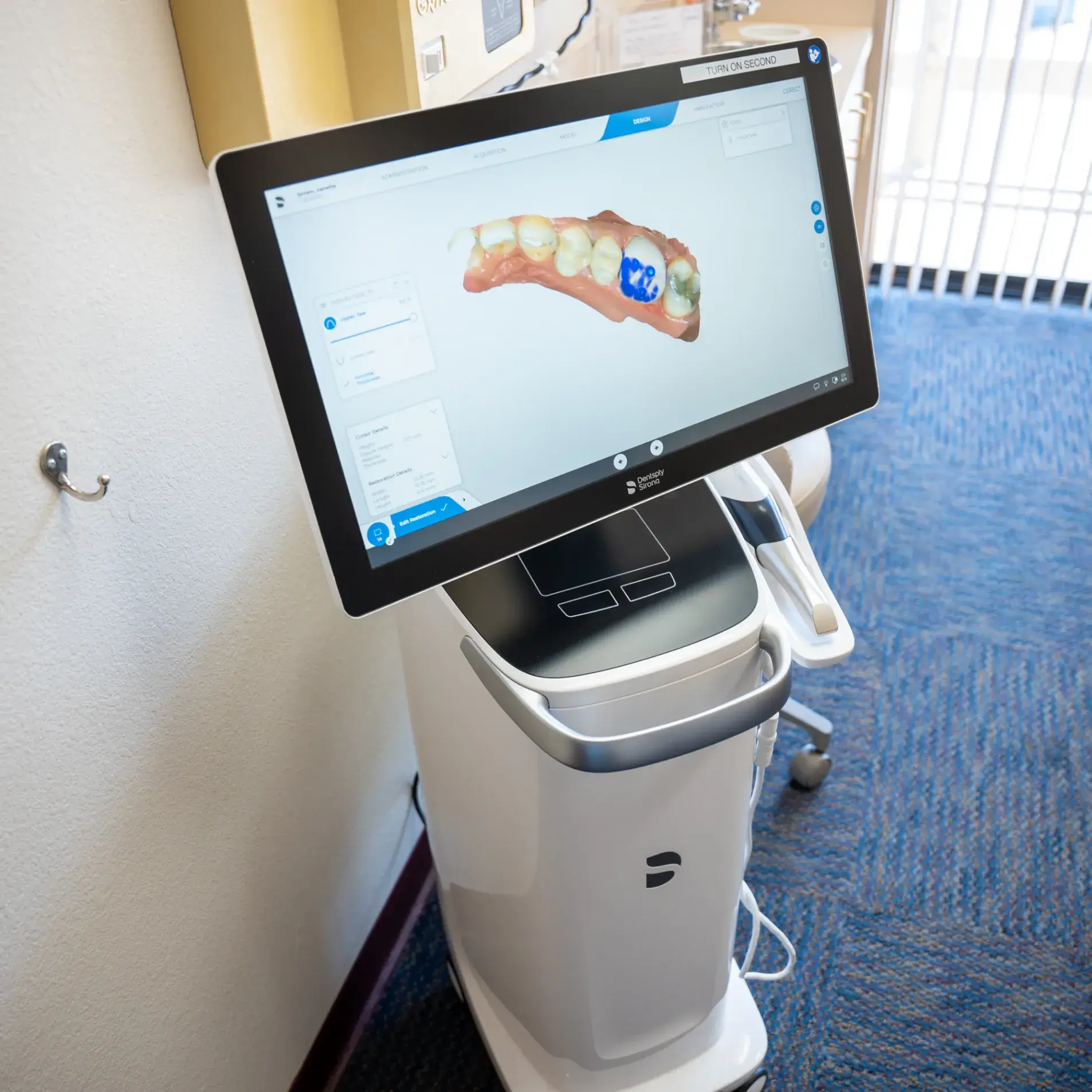 Dental scanning machine displaying a colored 3D model of teeth on its screen.
