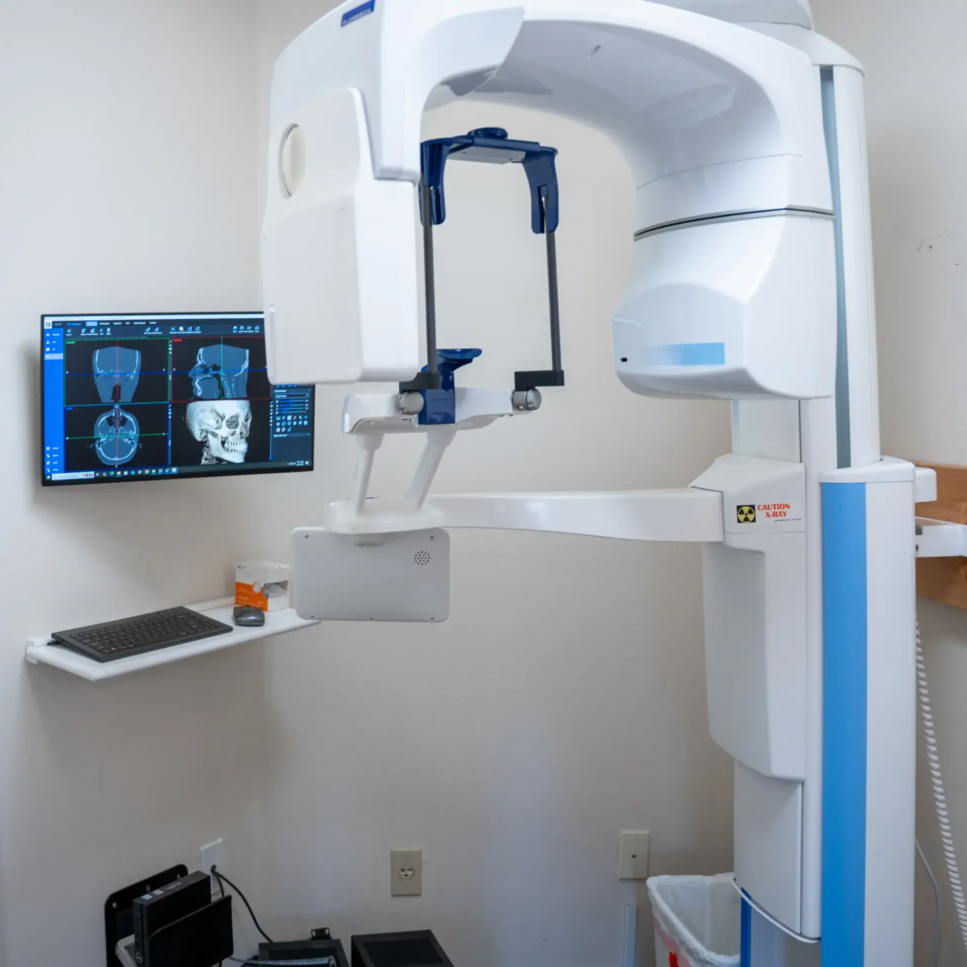 Dental imaging machine in a room with a computer screen showing dental scans.