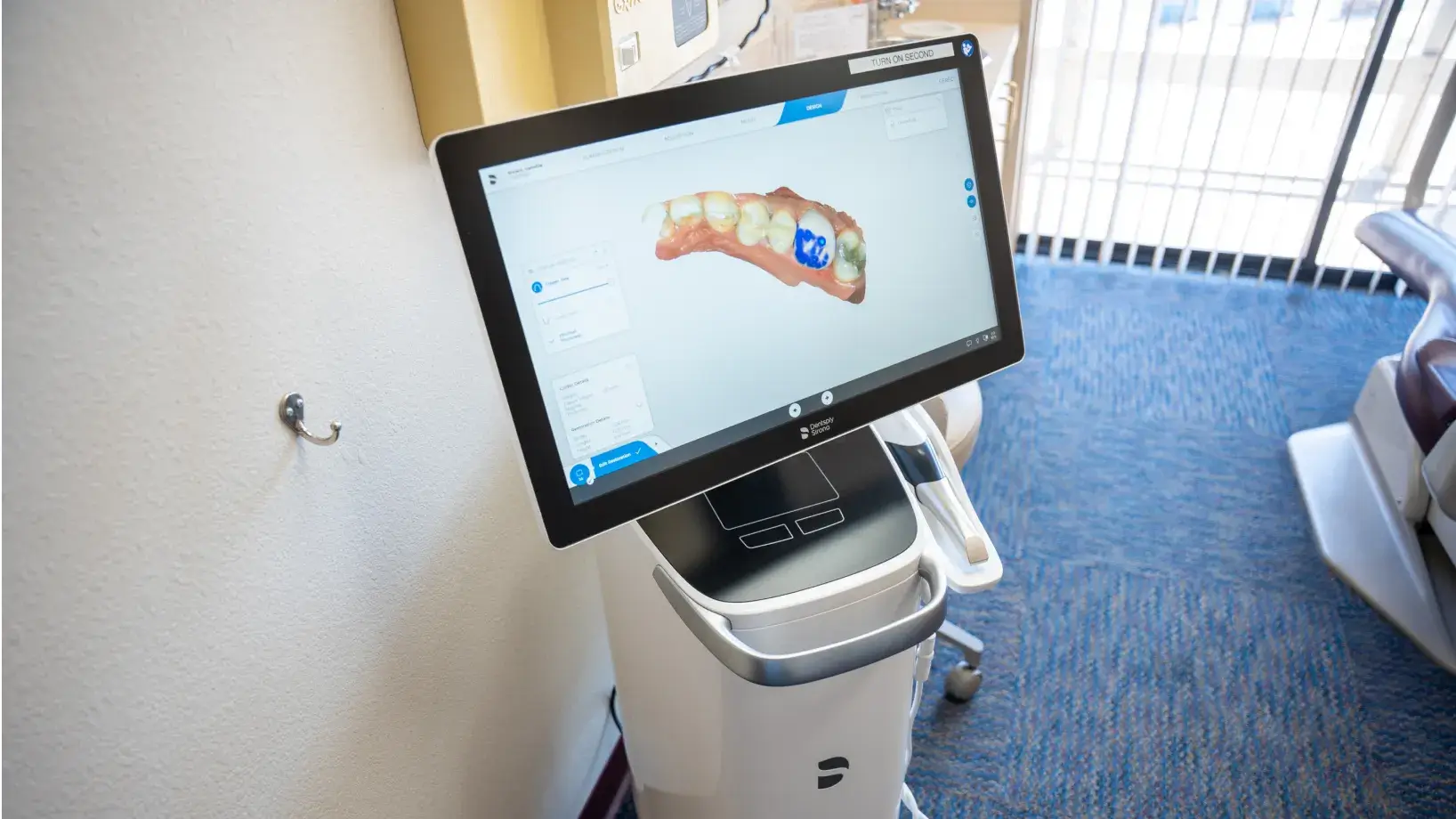 A dental scanner displays a 3D model of teeth on its screen.
