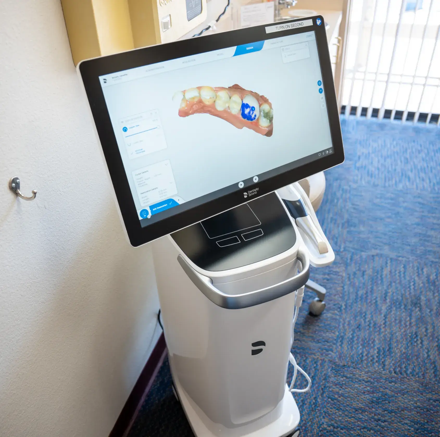 Dental equipment with a large screen displaying a digital model of a set of teeth.