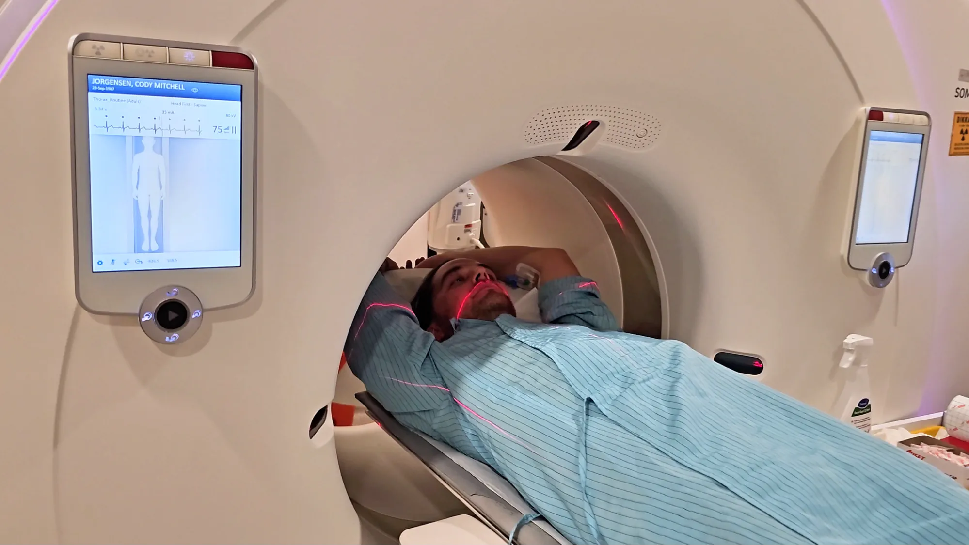 A patient lies inside a CT scanner with a monitor displaying scan settings at Memorial Hospital.
