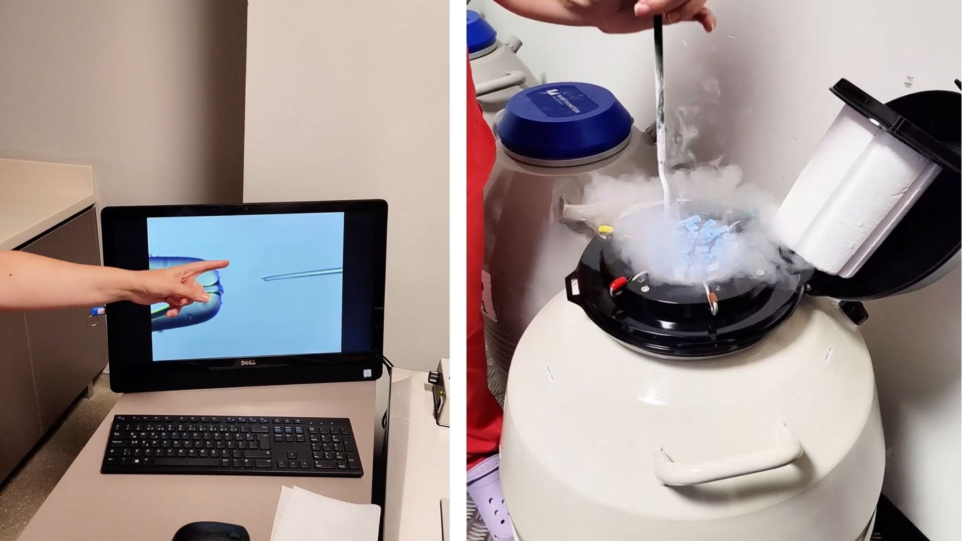 Side-by-side photos of IVF process: one showing finger pointing at injection on screen, and another of cryopreservation tank with liquid nitrogen.