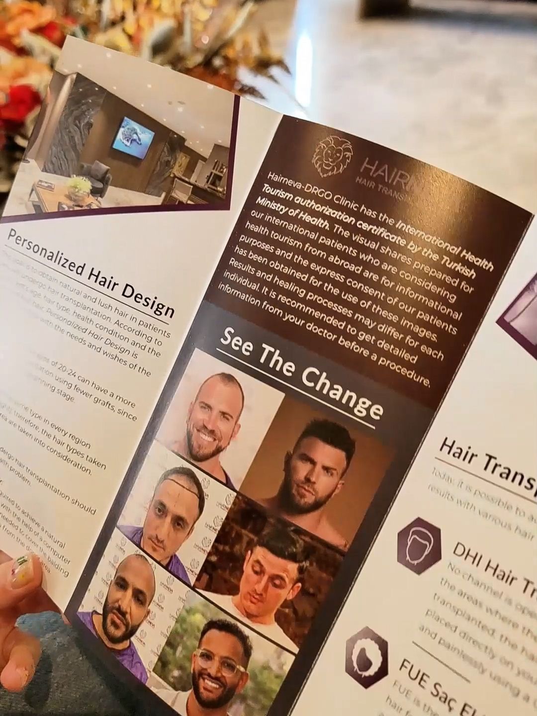 Brochure from Turkish hair transplant clinic showing before-and-after photos of patients and detailed hair design information.