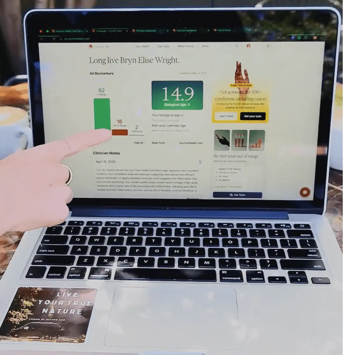 A laptop screen showing futuristic health biomarker results and biological age analysis, with a person pointing at the data.  