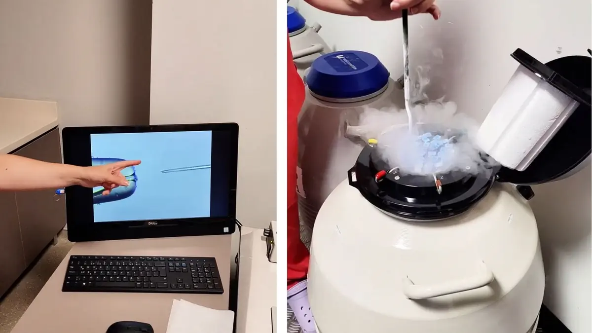 IVF process demonstration with embryo imaging on a monitor and cryopreservation equipment using liquid nitrogen at a fertility clinic in Istanbul.