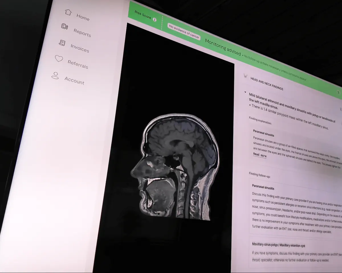 Close-up of AI-powered MRI brain scan report showing sinus findings and cancer screening results from affordable Function Health full-body scan in the USA.