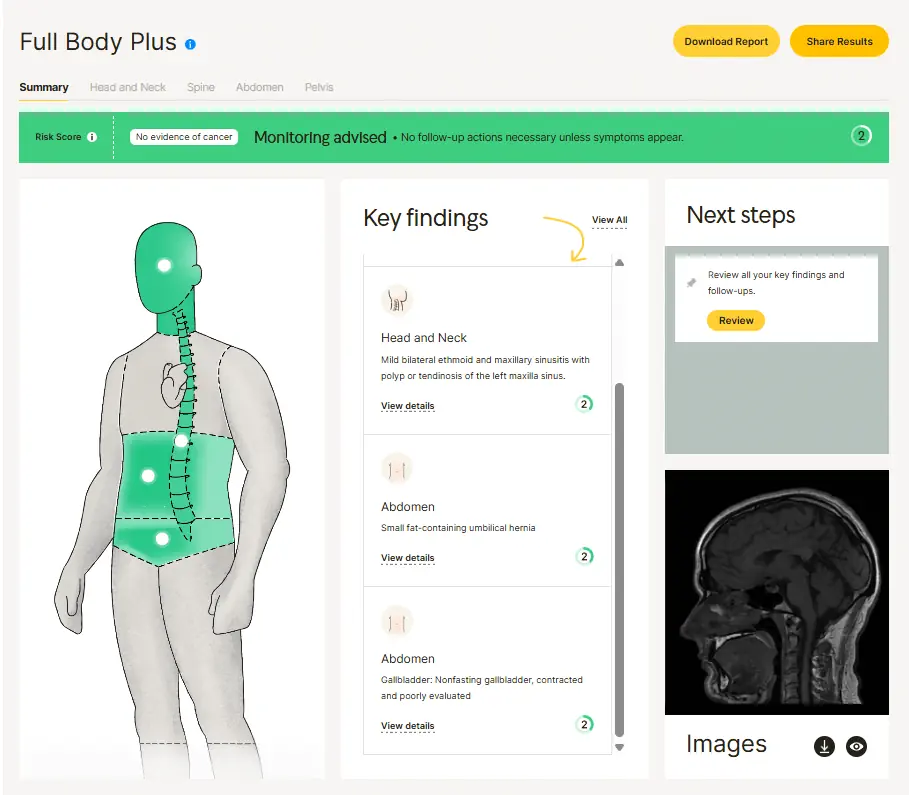 Full Body Plus MRI health scan report showing key findings for head, neck, and abdomen, with next steps and no evidence of cancer highlighted.