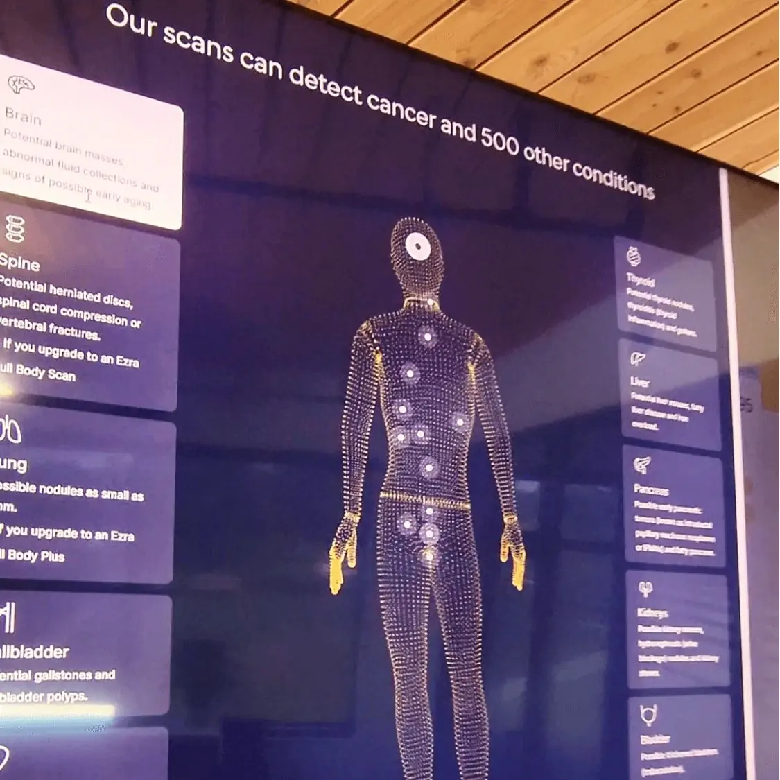 Digital display of a full-body MRI scan highlighting areas where cancer and 500+ conditions can be detected, including brain, spine, lungs, liver, and pancreas.