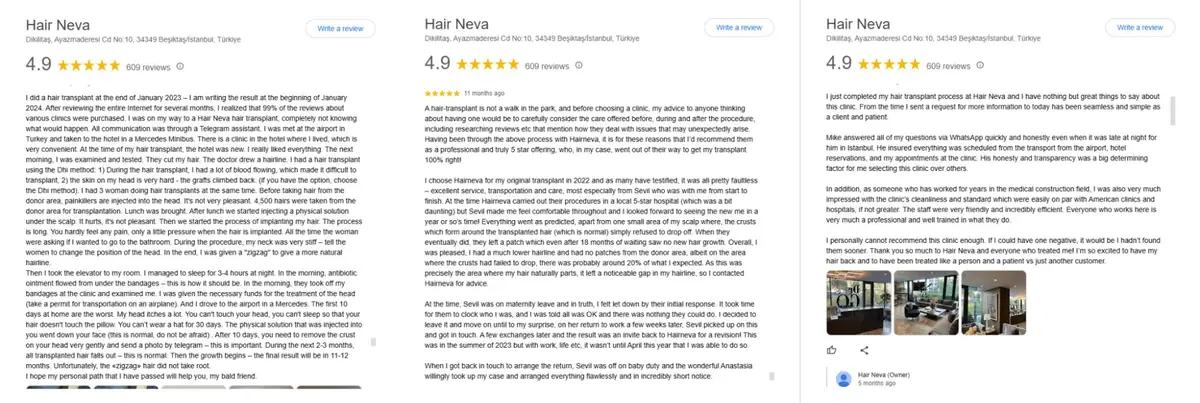 Screenshot of Hair Neva Clinic’s Google reviews in Istanbul, showing a 4.9-star rating with over 600 reviews from satisfied hair transplant patients.