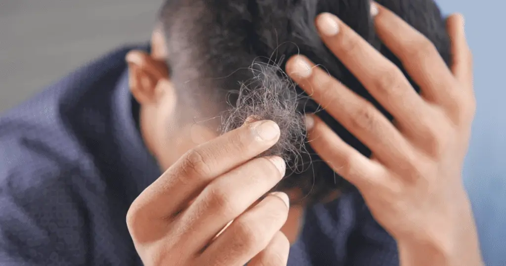 hair loss - divorce