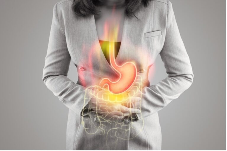Esopgageal Inflammation