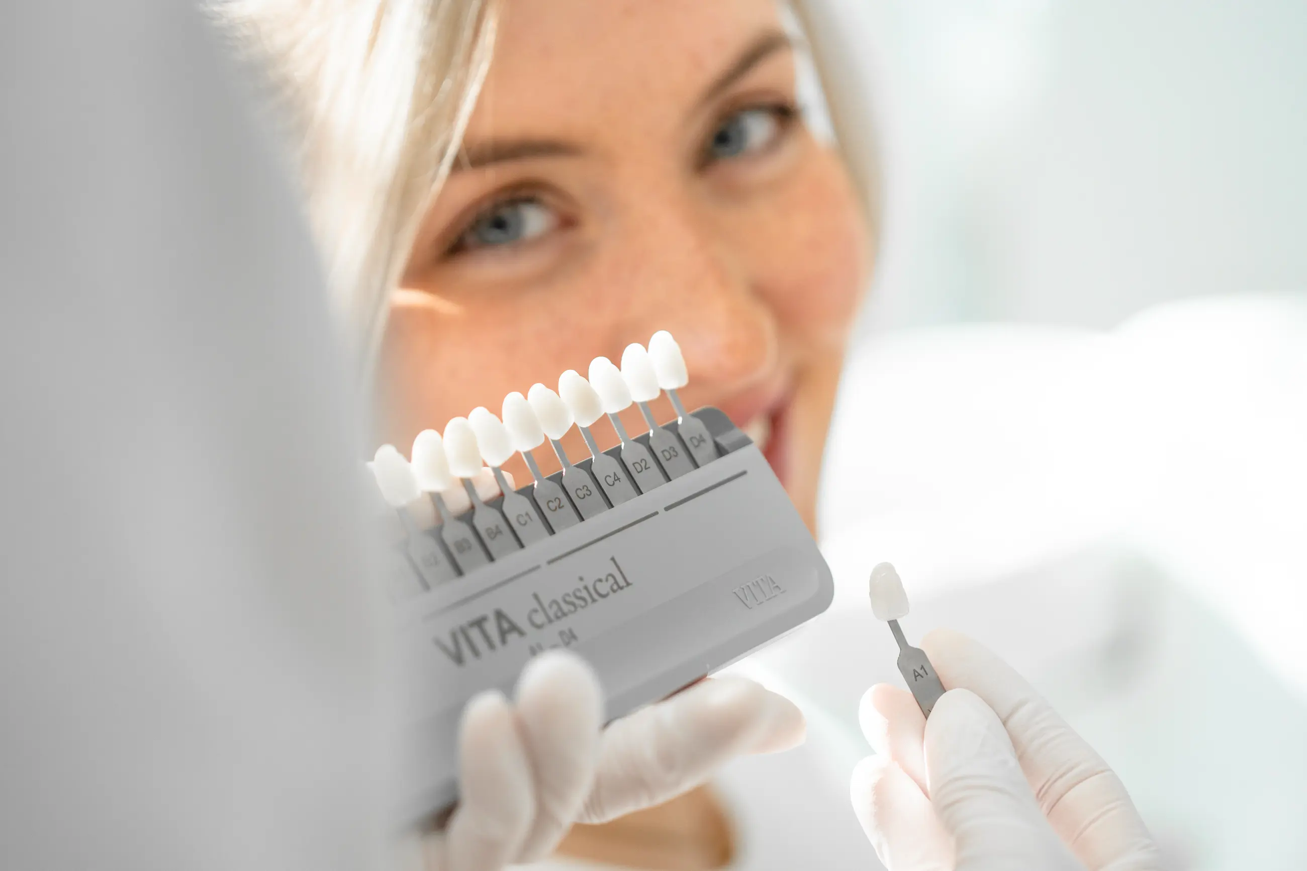 Abgleich von Zahnfarben