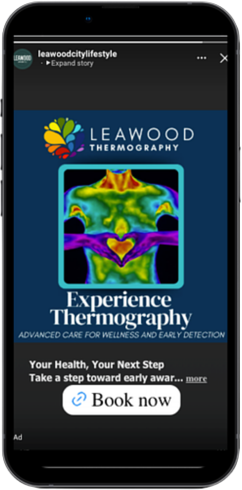 Instagram Story ad for Leawood Thermography reading Experience Thermography, advanced care for wellness and early detection, with a Book now button