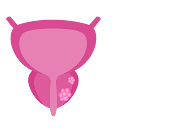 Prostate cancer