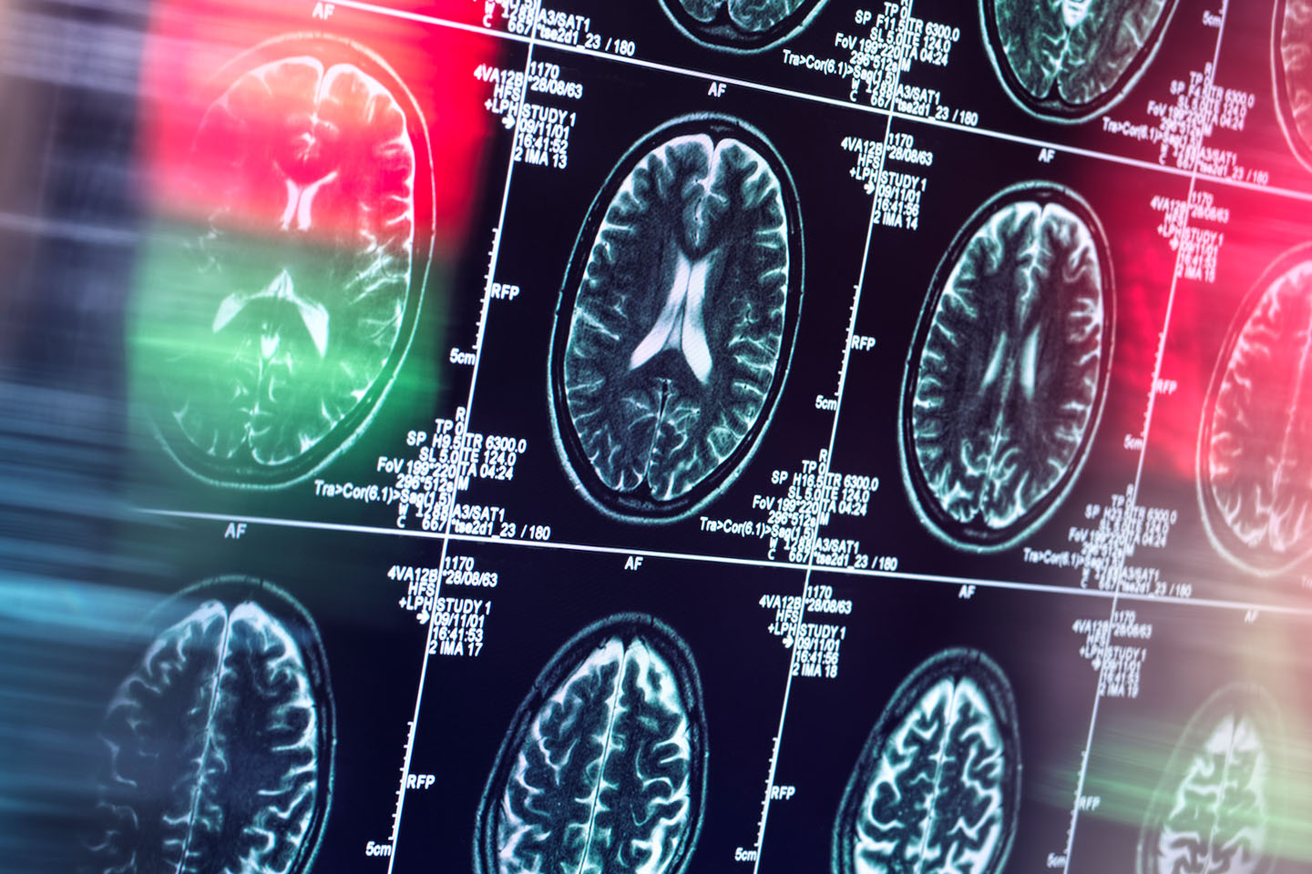 For the next neuroscience breakthroughs, look to smaller biotech companies