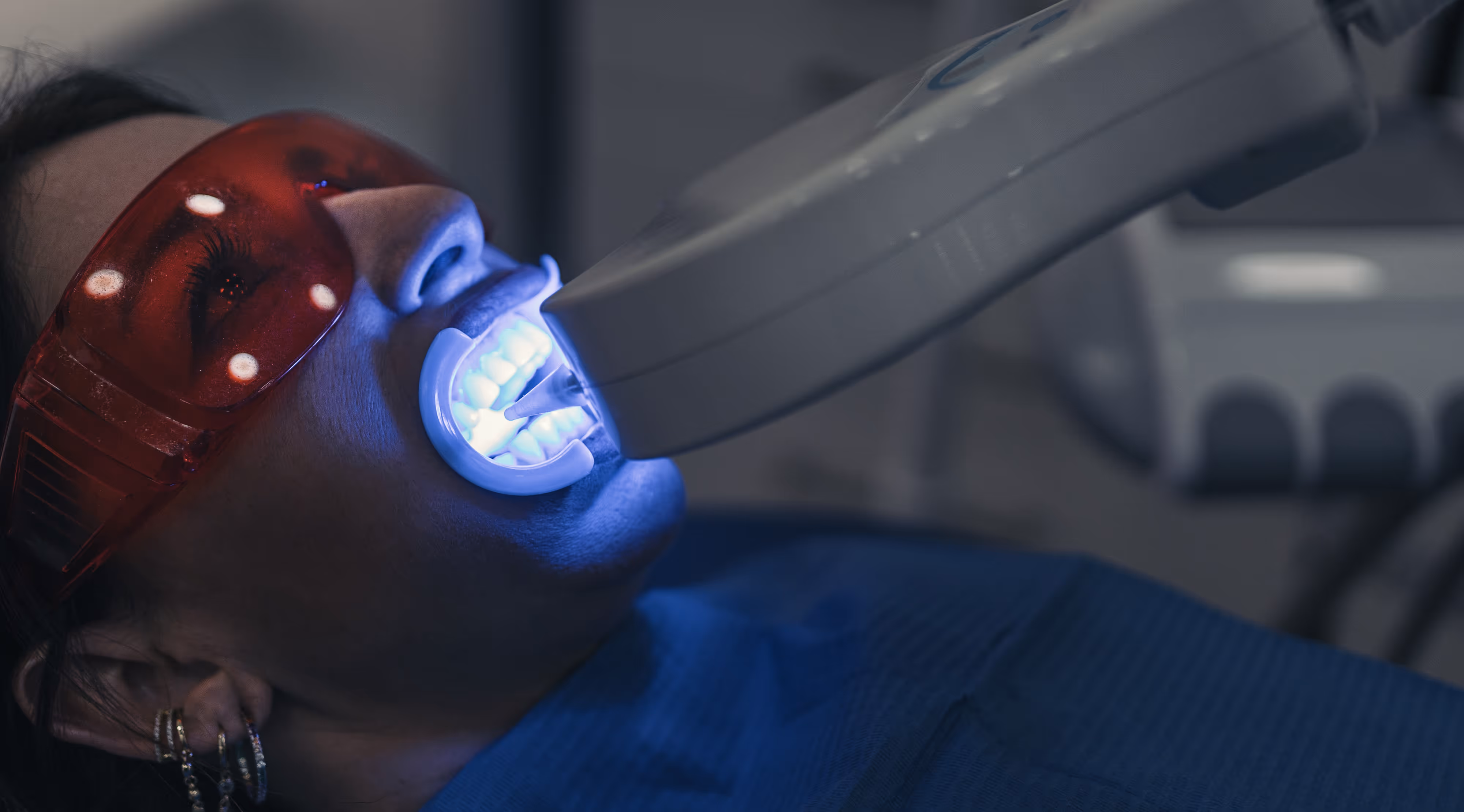 Digital intraoral scan at Magic Smiles