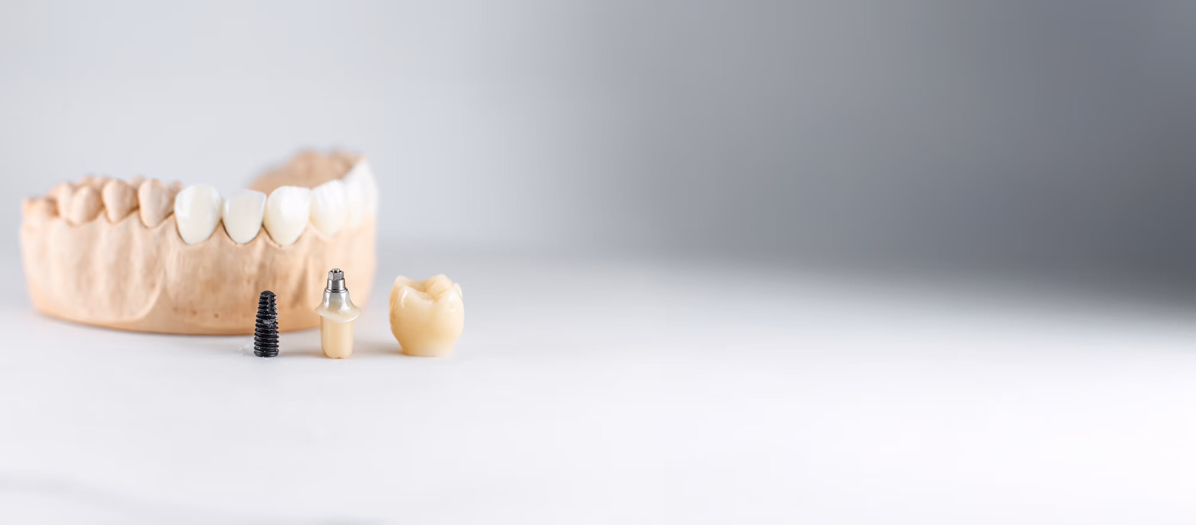 Digital intraoral scan at Magic Smiles