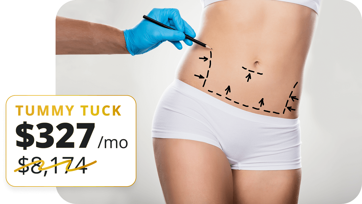 A surgeon marks a woman’s abdomen for a tummy tuck procedure, with financing shown at $327 per month.