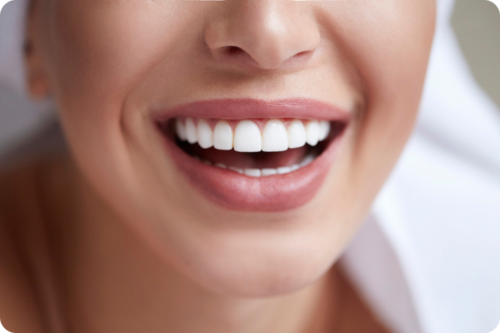 Close-up of a woman’s bright white smile with new dental veneers treatment.