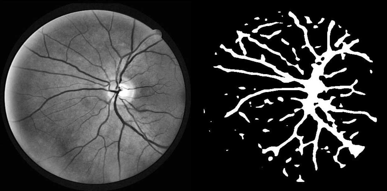 A retina scan on the left and the blood-vessel map a model traced from it on the right