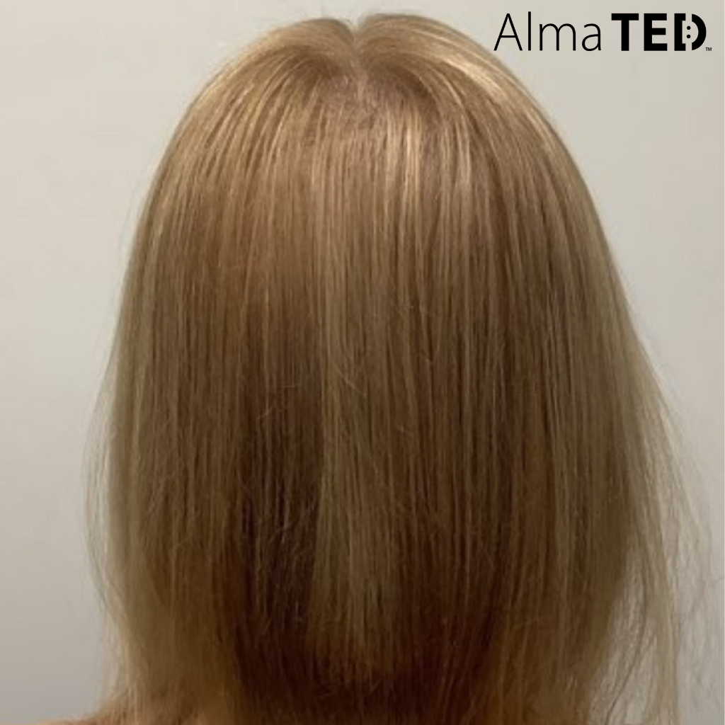 Before and after images