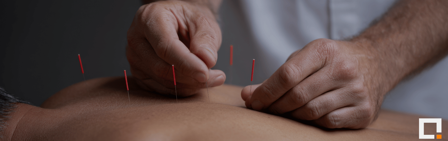 Acupuncture après 60 ans 2026 : indications + remboursement