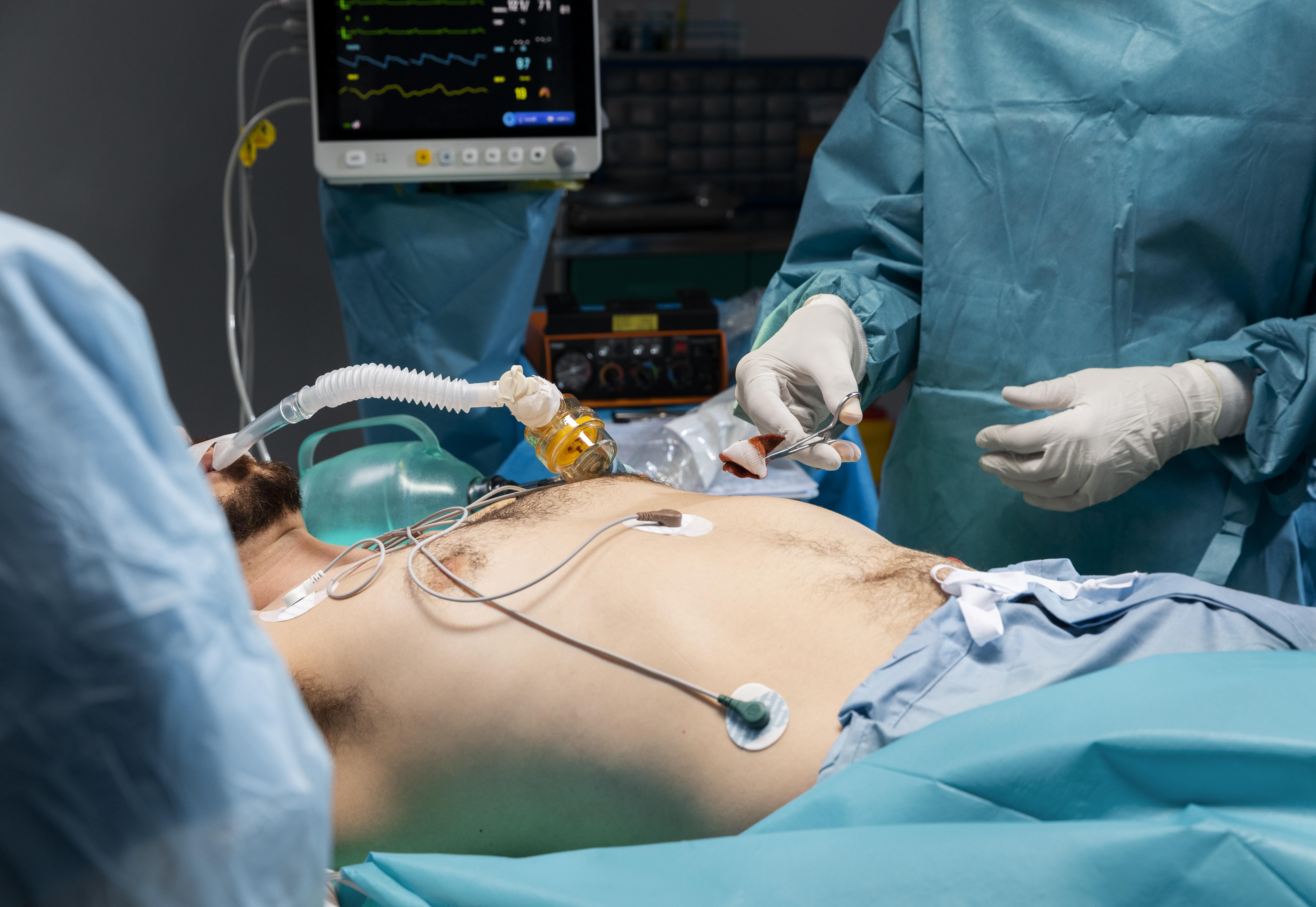 CPT Code for Laparoscopic Cholecystectomy Explained: Billing, Reimbursement, and Common Errors