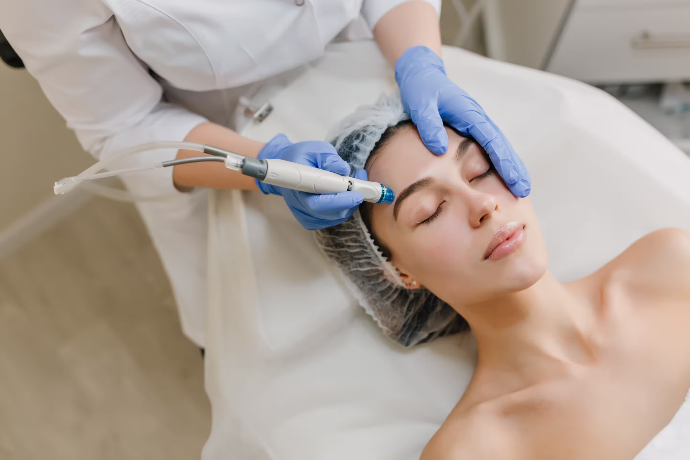 Micro neelding sur le visage