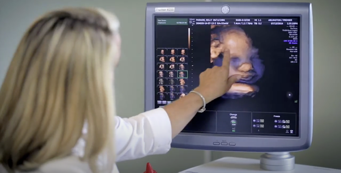 Sonographer pointing to ultrasound screen. 