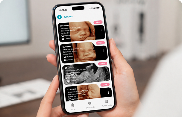 Image of a sonographer giving a pregnant woman an ultrasound