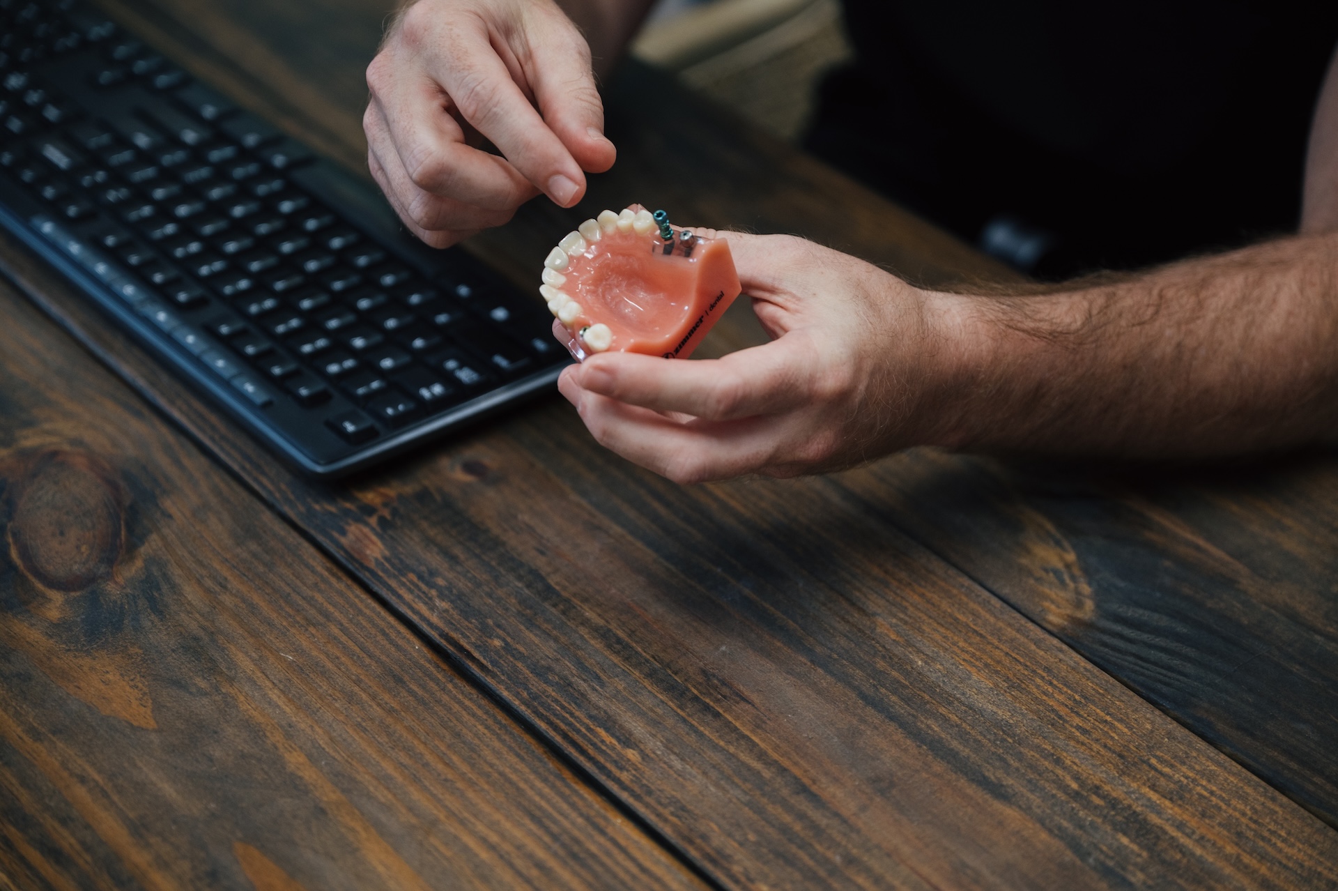A pair of hands holding a dental model that exemplifies how dental implants are placed in the jaw