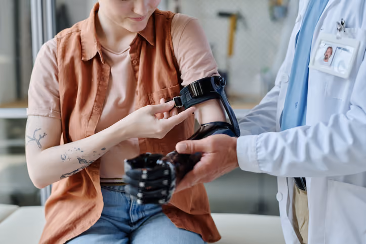 Clinician fitting a myoelectric prosthetic hand and forearm socket on a young woman