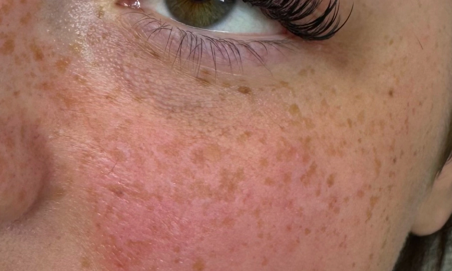 Nahaufnahme eines Auges mit langen, gestylten Wimpern und natürlichen Sommersprossen – Lash Extensions von I AM A PRIORITY
