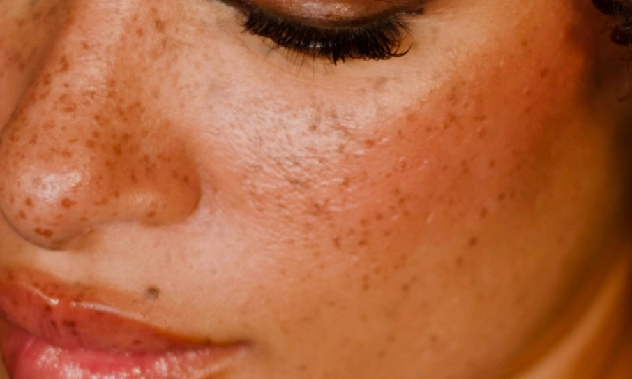 Nahaufnahme eines Auges mit langen, gestylten Wimpern und natürlichen Sommersprossen – Lash Extensions von I AM A PRIORITY