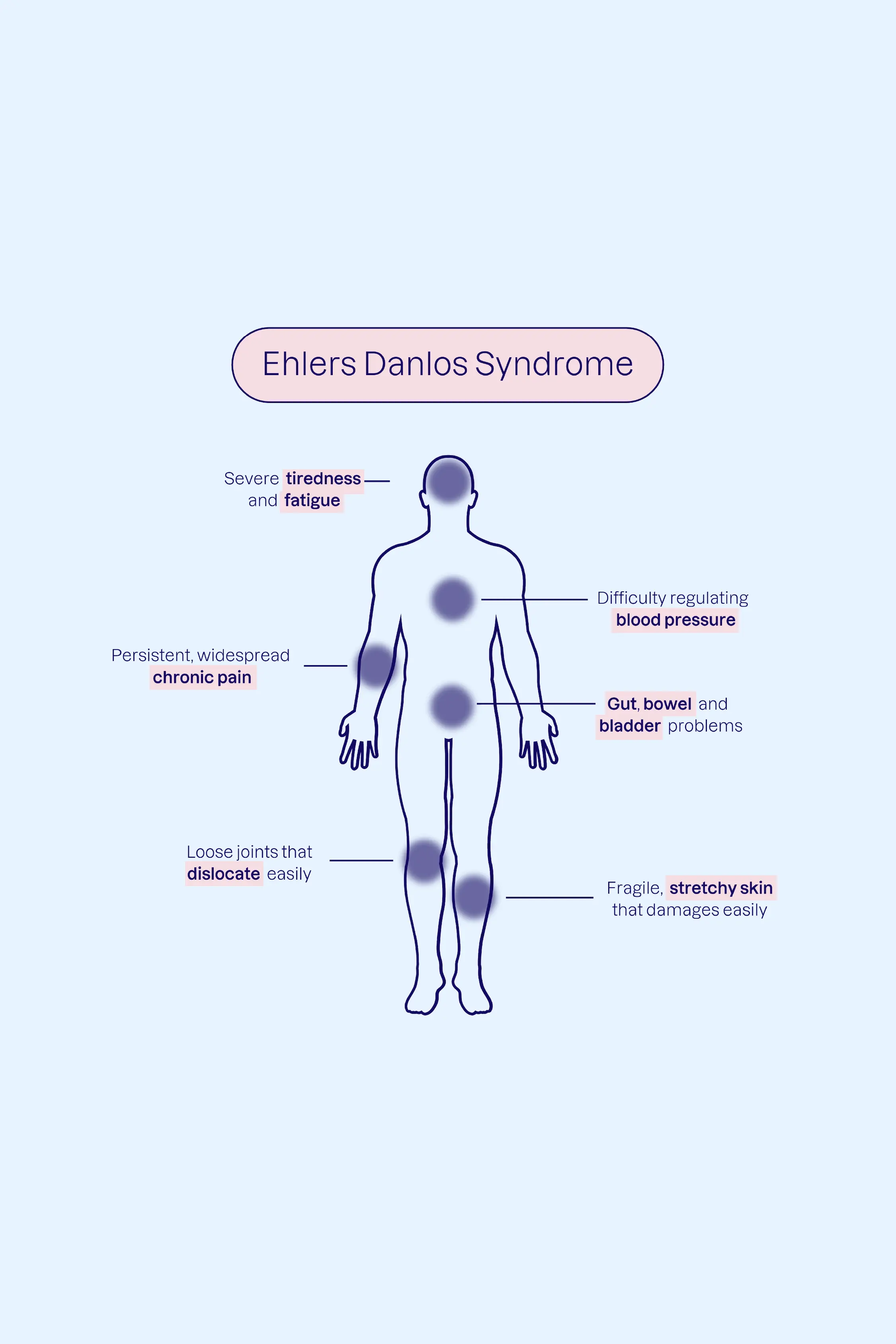 Ehlers-Danlos Syndrome infographic, showing the various symptoms (e.g. chronic pain, gut problems, etc) that are treatable with medical cannabis