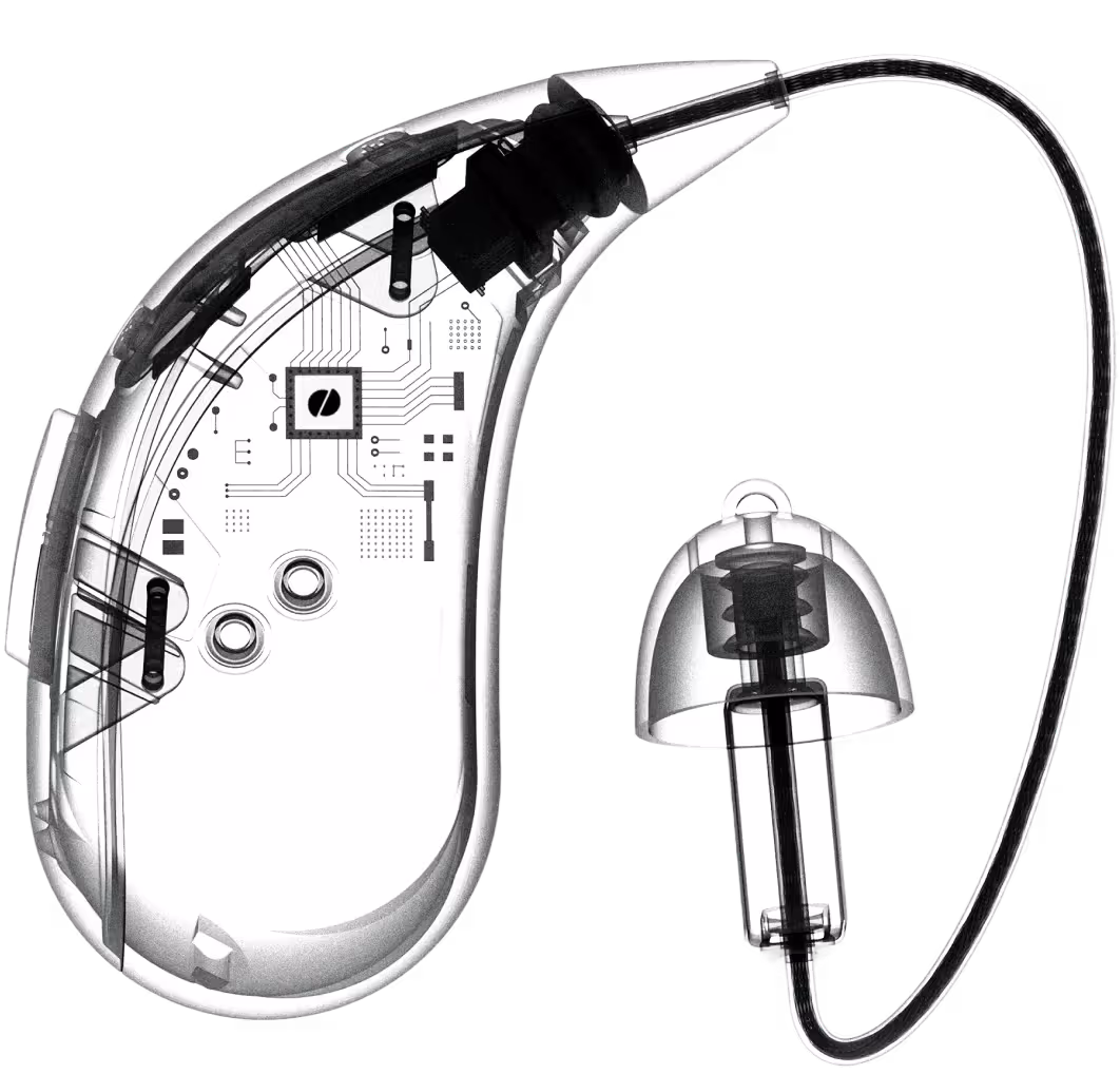 X-Ray view of inner components of a Fortell hearing aid.
